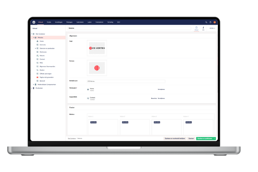 Umbraco Cms Website Ics Vertex